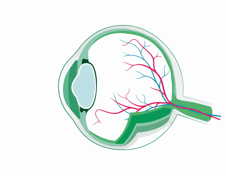 Animazione — distacco di retina
